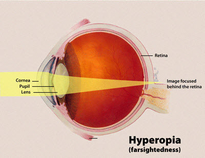 how-lungimiranza-works